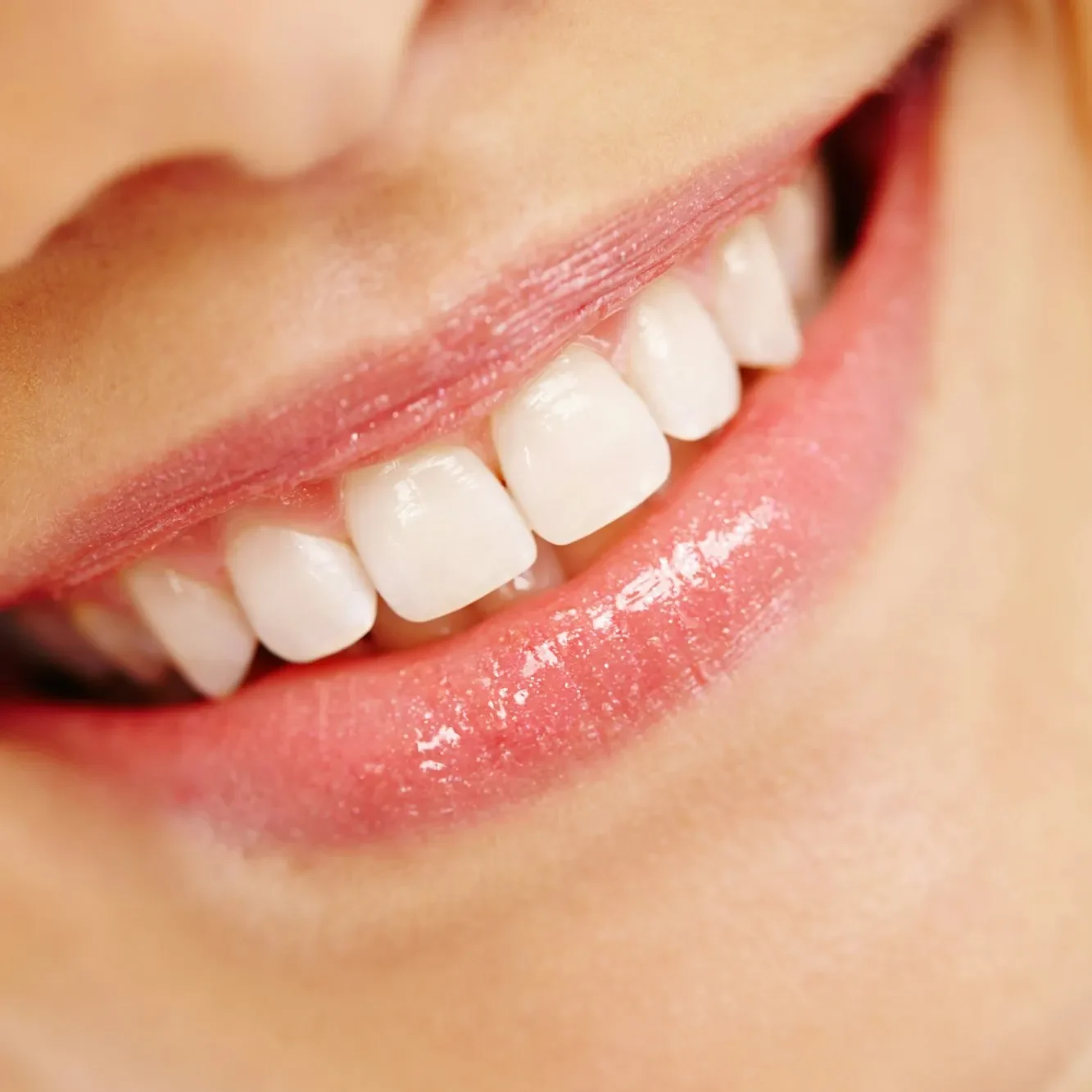 otturazioni dentali sorriso cristaldent torino
